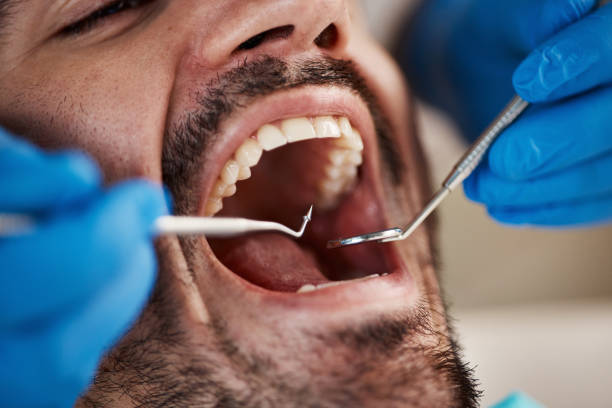 Best Tooth Infection Emergency Dentist  in Alburtis, PA